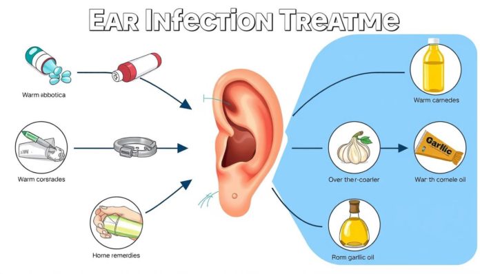 Ear Infection Treatments